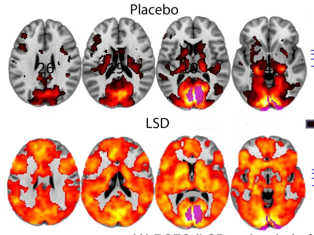 lsd, que es lsd, lsd efectos, lsd droga​, lsd genious​, como consumir lsd​, lsd fotos reales​, microdosing lsd, how to microdosing lsd, aspergers lsd microdosing​, does microdosing lsd keep you awake, lsd efectos, lsd droga​, lsd​, lsd dream emulator, lsd перевод​, lsd and schizophrenia​, lsd weed​, strain lsd​, lsd nedir​, lsd uyuşturucu, lsd kafası, lsd etkileri, lsd fiyatı, lsd nasıl yapılır, lsd film, lsd kullananlar​, lsd satın al​, kabe lsd, lsd kullanan ressam, lsd müzikleri​, lsd weed, lsd ยา, lsd gif, flower lsd​, torsen lsd​, lsd rave​, lsd 專輯, 慢跑 lsd​, microdosing lsd, lsd wirkung​, 1p lsd​, 1p lsd shop​, 1p lsd flashback, lsd antipsychotics, lsd artwork, lsd hur länge, lsd p1, subaru brz lsd​, loomis lsd 100, lsd 600 ug, lsd drug test time​, lsd tolerance calc, lsd xxx​, mickey mouse lsd​, lsd tabs, mixing shrooms and lsd​, how do you take lsd​, lsd ucinky, lsd come up​, sleeping on lsd, genius lsd​, lsd droga ucinky, lsd india, lsd visuals, msd lsd​, how much does lsd cost​, lsd in india, how to get lsd,lsd iskustva, 1943 lsd​, albert hoffman lsd, lsd bike, eyes on lsd,