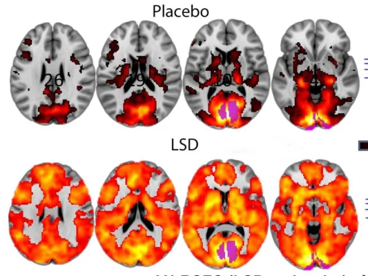 lsd, que es lsd, lsd efectos, lsd droga​, lsd genious​, como consumir lsd​, lsd fotos reales​, microdosing lsd, how to microdosing lsd, aspergers lsd microdosing​, does microdosing lsd keep you awake, lsd efectos, lsd droga​, lsd​, lsd dream emulator, lsd перевод​, lsd and schizophrenia​, lsd weed​, strain lsd​, lsd nedir​, lsd uyuşturucu, lsd kafası, lsd etkileri, lsd fiyatı, lsd nasıl yapılır, lsd film, lsd kullananlar​, lsd satın al​, kabe lsd, lsd kullanan ressam, lsd müzikleri​, lsd weed, lsd ยา, lsd gif, flower lsd​, torsen lsd​, lsd rave​, lsd 專輯, 慢跑 lsd​, microdosing lsd, lsd wirkung​, 1p lsd​, 1p lsd shop​, 1p lsd flashback, lsd antipsychotics, lsd artwork, lsd hur länge, lsd p1, subaru brz lsd​, loomis lsd 100, lsd 600 ug, lsd drug test time​, lsd tolerance calc, lsd xxx​, mickey mouse lsd​, lsd tabs, mixing shrooms and lsd​, how do you take lsd​, lsd ucinky, lsd come up​, sleeping on lsd, genius lsd​, lsd droga ucinky, lsd india, lsd visuals, msd lsd​, how much does lsd cost​, lsd in india, how to get lsd,lsd iskustva, 1943 lsd​, albert hoffman lsd, lsd bike, eyes on lsd,